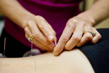 Dubbo Acupuncture & Carter Chiropractic - Dentist Find 1