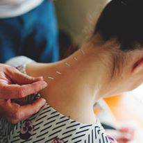 Scott Martin Acupuncture