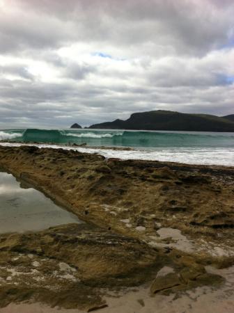 Bruny Island Berry Farm - Dentist Find 0