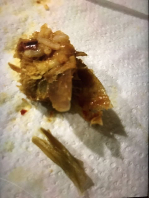 Mr Soy Boy - Dentist Find 5