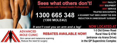 Advanced Mole Clinic