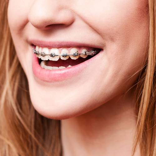 Cairns Specialist Orthodontists
