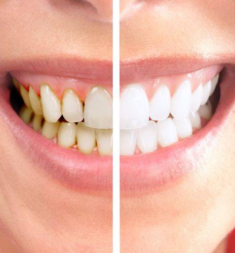 Stockrington NSW Dentist Find