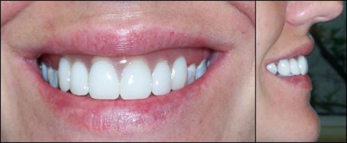 Active Denture Clinic