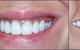 Active Denture Clinic - thumb 0
