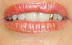 Active Denture Clinic - thumb 2
