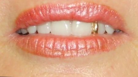 Active Denture Clinic - Dentist Find 2