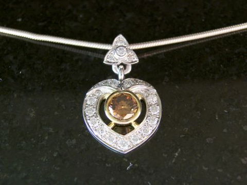 Burchell’s Jewellers - Dentist Find 4
