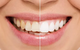 Newcastle Dental Care - thumb 3