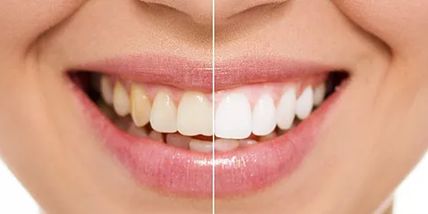 Newcastle Dental Care - Dentist Find 3