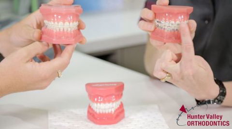 Hunter Valley Orthodontics - Dentist Find 30