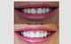 A Plus Family Dental - thumb 4