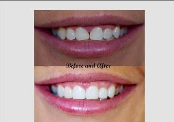 A Plus Family Dental - Dentist Find 12