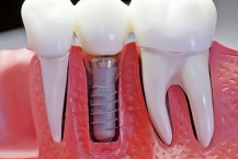 Currey & Jorgensen Cosmetic Dentistry Pty Ltd - Dentist Find 7