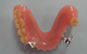 Port Stephens Denture Clinic - thumb 1