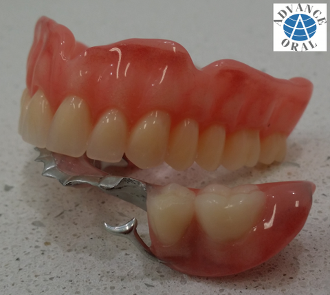 Advance Oral Denture Clinic - Dentist Find 12