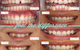 Fresh Dental Care - thumb 7