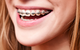 Cairns Specialist Orthodontists - thumb 11