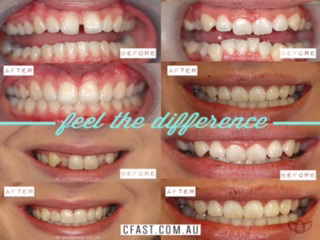 Fresh Dental Care - Dentist Find 35