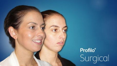 Profilo Surgical - Dentist Find 4
