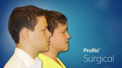Profilo Surgical - Dentist Find 5