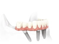 Specialist Oral Surgery