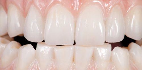 Dentiform Australia Pty Ltd