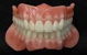 Denture Excellence Nerang - thumb 1