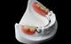 Denture Excellence Nerang - thumb 2