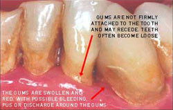 Crown Dental Surgery - Dentist Find 0