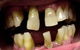 Crown Dental Surgery - thumb 1