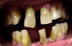 Crown Dental Surgery - Dentist Find 1
