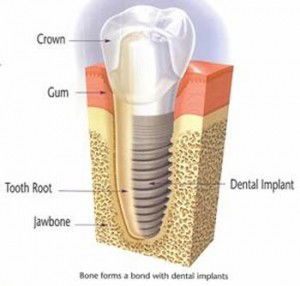 Crown Dental Surgery - Dentist Find 2