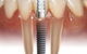Crown Dental Surgery - thumb 3