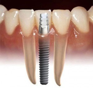 Crown Dental Surgery - Dentist Find 3