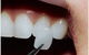 Crown Dental Surgery - thumb 5