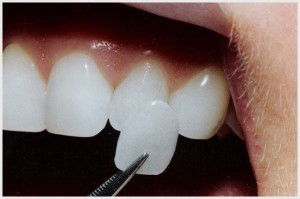 Crown Dental Surgery - Dentist Find 5