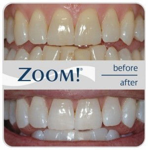 Crown Dental Surgery - Dentist Find 6