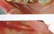 Crown Dental Surgery - thumb 7
