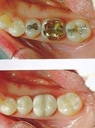 Crown Dental Surgery - Dentist Find 7
