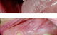 Crown Dental Surgery - thumb 8