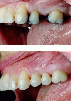 Crown Dental Surgery - Dentist Find 8