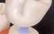 Crown Dental Surgery - thumb 9