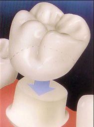 Crown Dental Surgery - Dentist Find 9