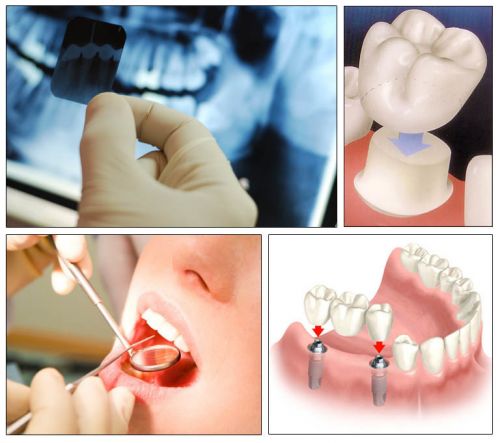 Bupa Dental