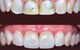 Clear Dental Chatswood - thumb 0