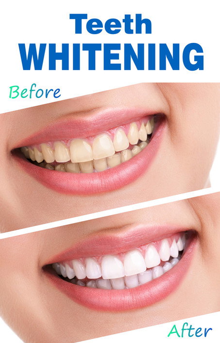 Hoppers Crossing Dentist - Dentists Australia 3