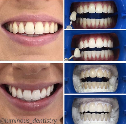 Luminous Dentistry - Dentist Find 44