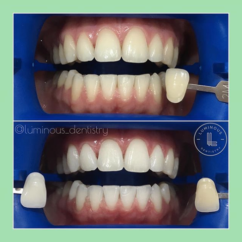 Luminous Dentistry - Dentist Find 36