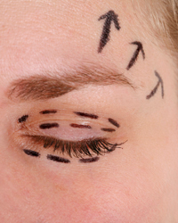 Queensland Plastic Surgery